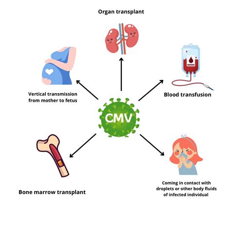 CMV